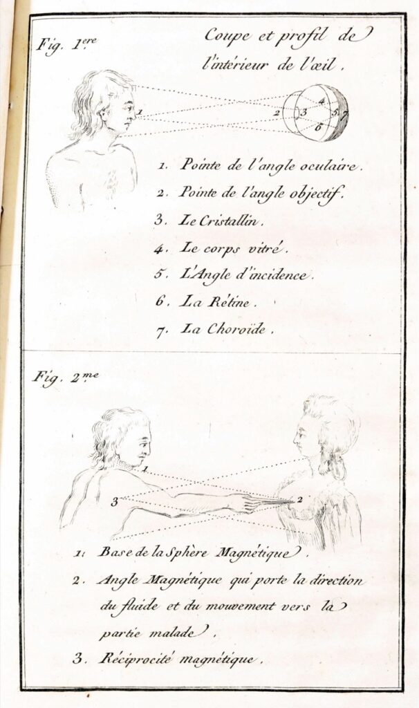 Diagram outlining the steps of animal magnetism. The second figure directs the reader to use a magnet to direct the magnetic fluid towards the body part in need of treatment.
(Source: La vision, contenant l'explication de l'écrit intitule by Jacques Cambry)