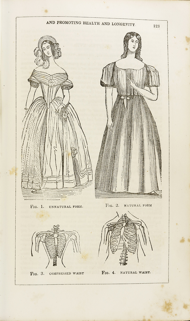 Medical effects of corset wearing, 19th Century illustration - Stock Image  - C036/8446 - Science Photo Library
